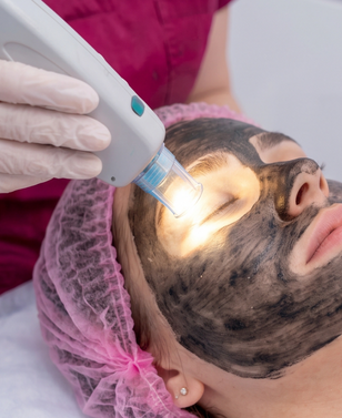 Signature Carbon Facial treatment