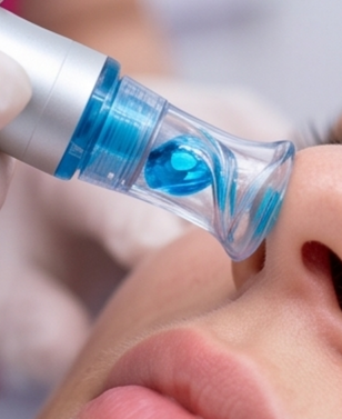 Deep-Cleansing HydraFacial treatment